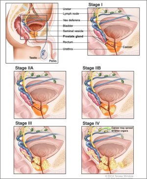 stages